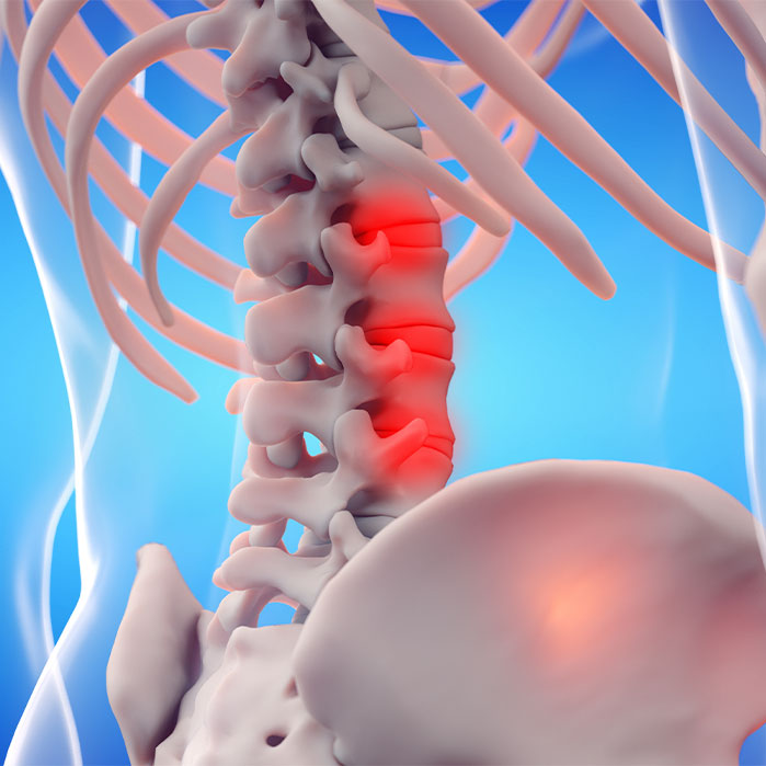 ankylosing spondylitis chiropractor in Tulsa OK