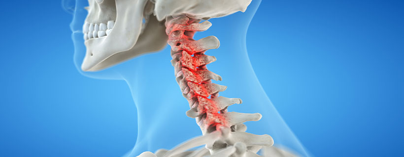 patient needing bone spur treatment in Tulsa