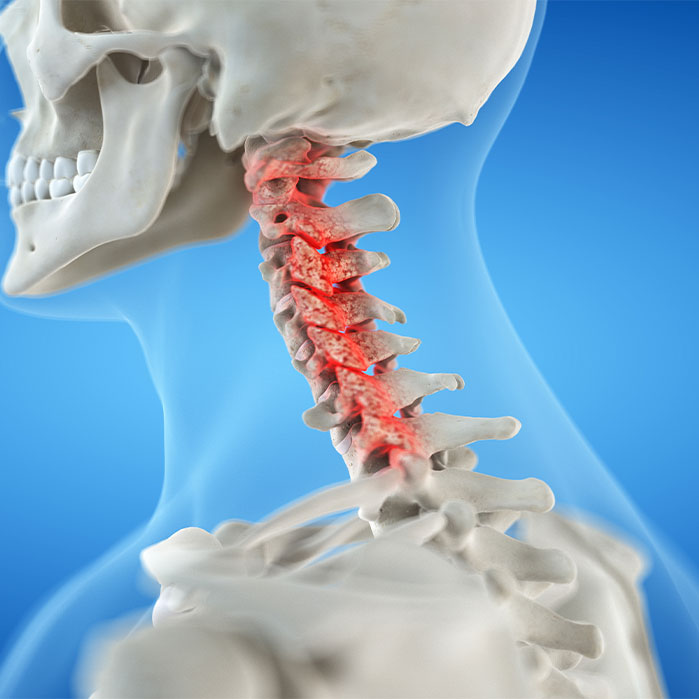 bone spur treatment in Tulsa OK