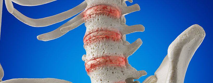 patient needing degenerative disc disease treatment in Tulsa
