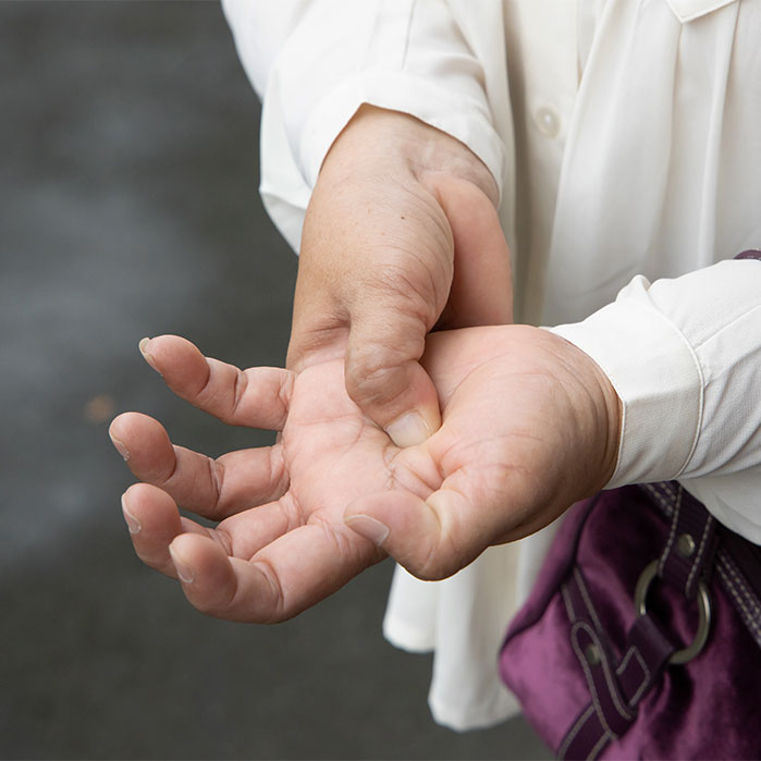 dupuytren contracture chiropractor in Tulsa OK
