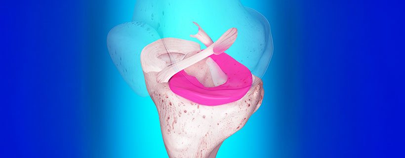 patient needing ligamentitis treatment in Tulsa