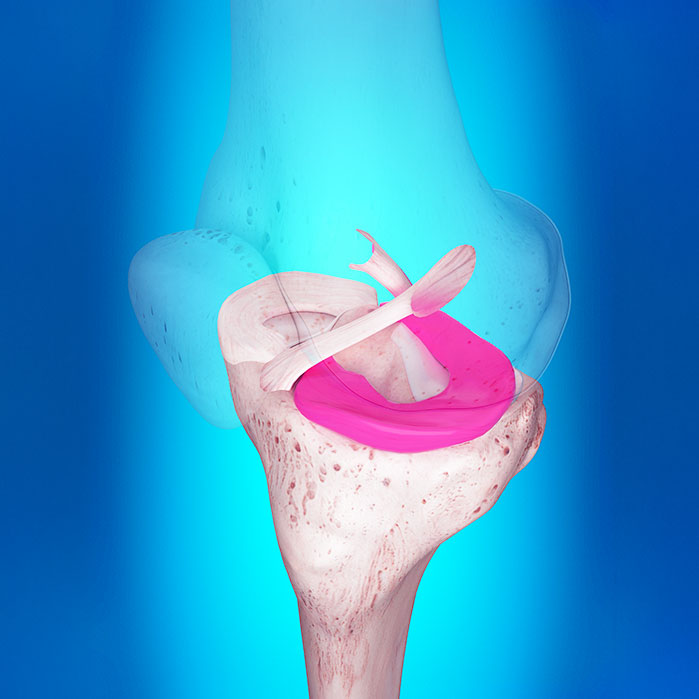 ligamentitis chiropractor in Tulsa OK