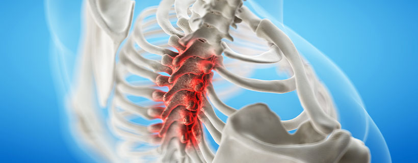 patient needing spinal stenosis treatment in Tulsa