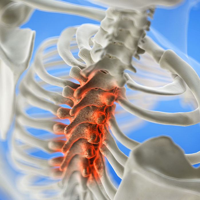 spinal stenosis treatment in Tulsa OK