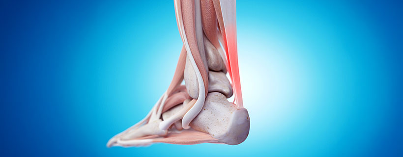 patient needing tendonitis treatment in Tulsa