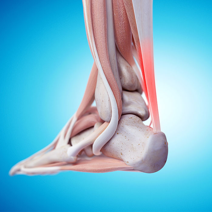 tendonitis chiropractor in Tulsa OK